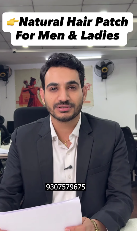 Natural Hair Patch in Nagpur – Without Hair Transplantation